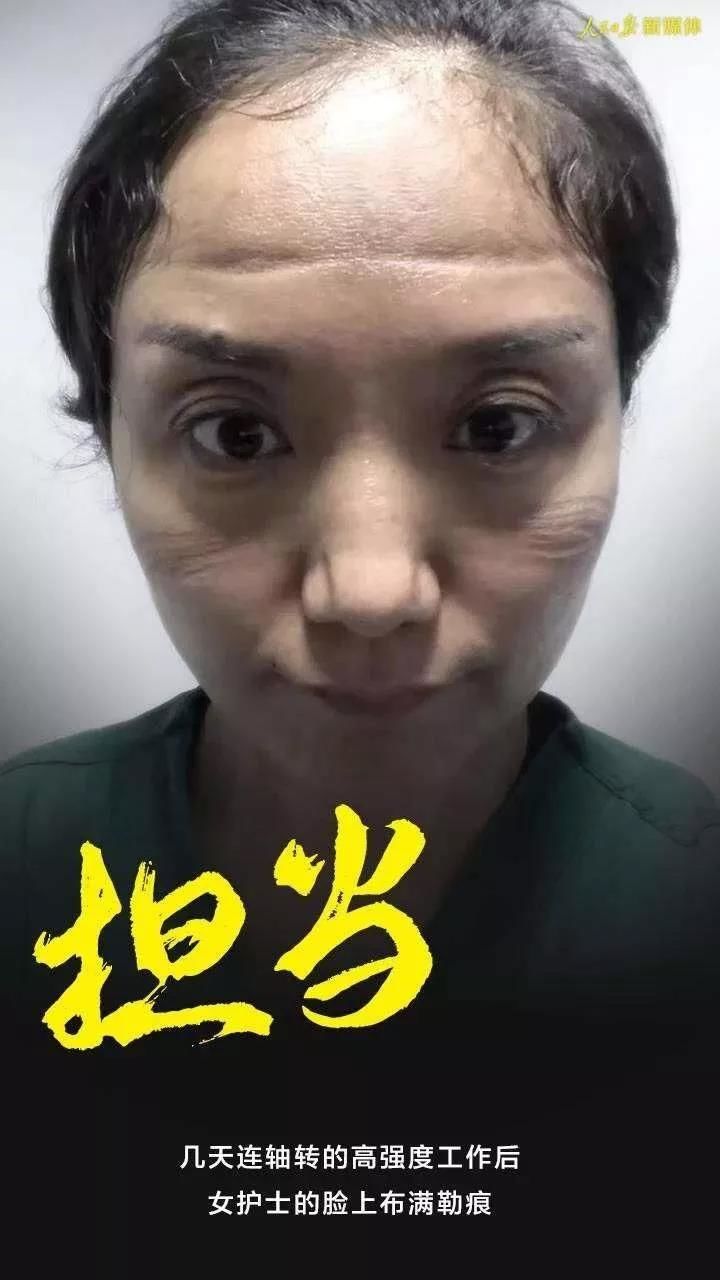 疫情防控四川在行动余元英口罩留在脸上的印记是上天送给白衣天使最美